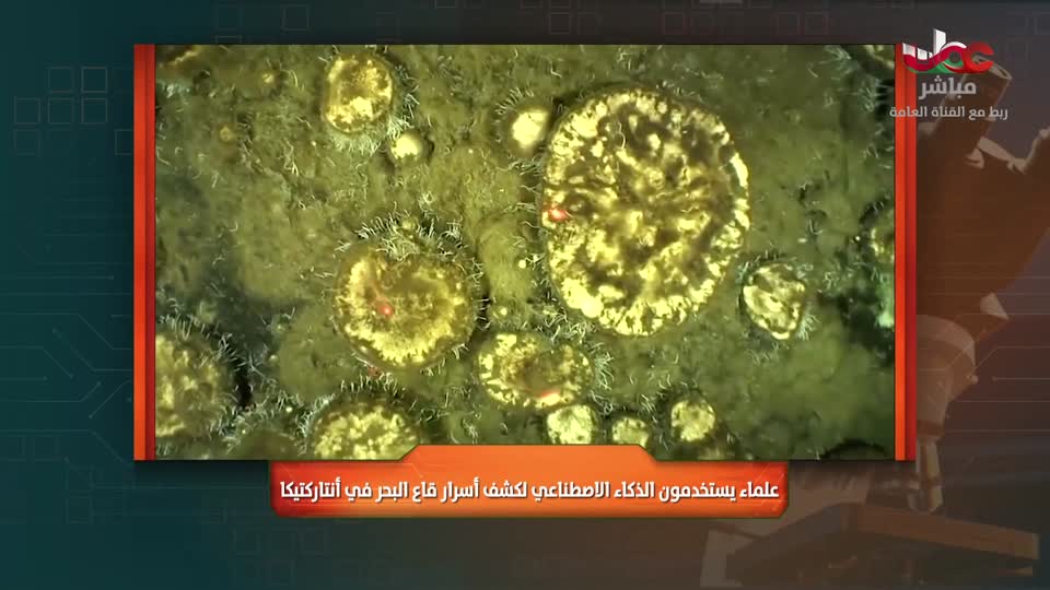 برنامج/المجهر