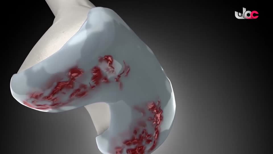 المسلسل الكرتوني - الاليون الصغار - الحلقة 18