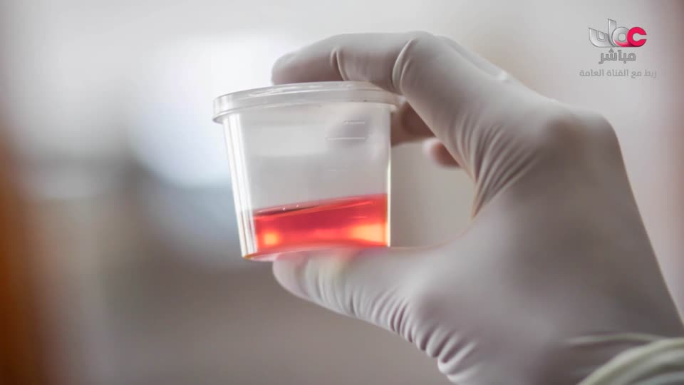 المسلسل الكرتوني - الاليون الصغار - الحلقة 23