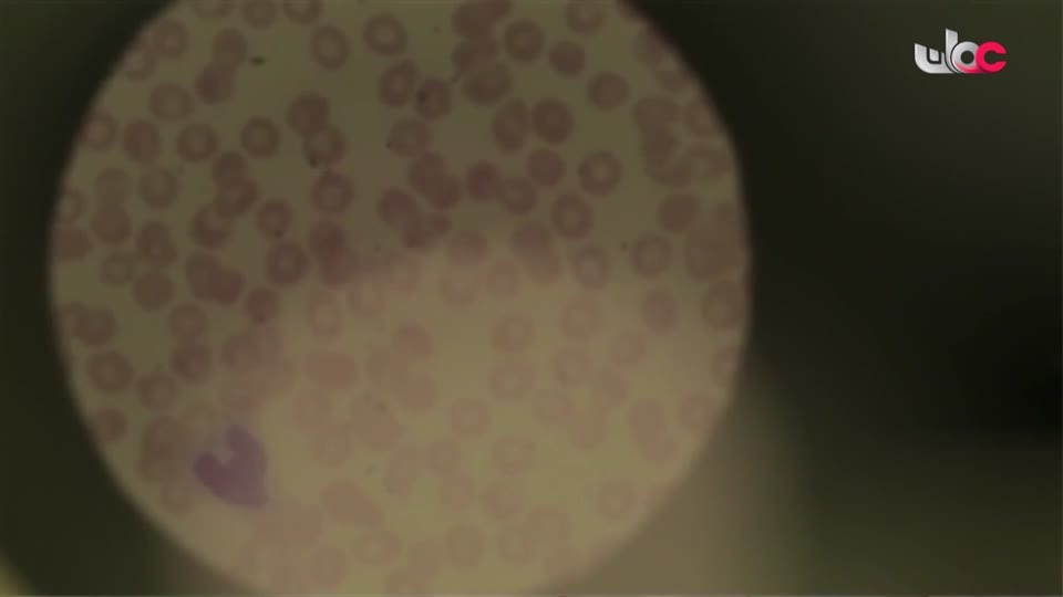 برنامج - اسرار الجسد - الحلقة 22