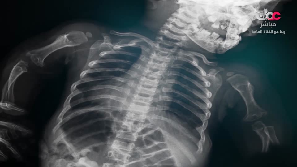 برنامج - اسرار الجسد - الحلقة 25