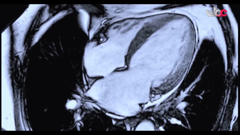 المسلسل العماني/ الفاغور