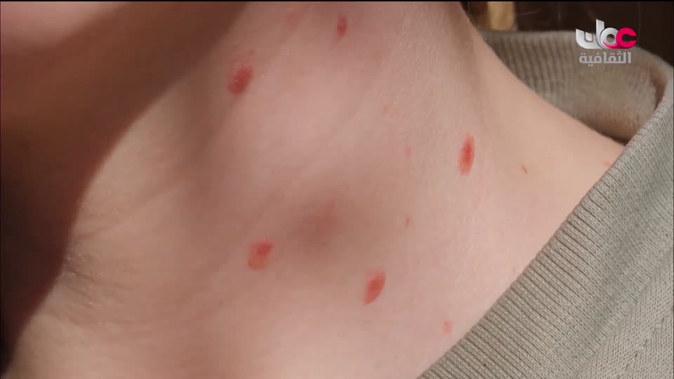 البرنامج الثقافي - زيوت عطرية - الحلقة 17