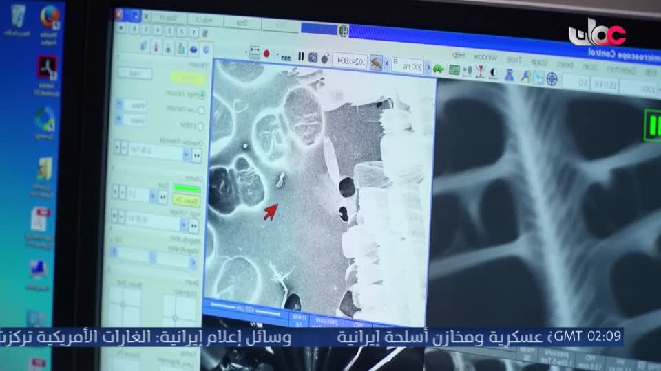 برنامج - اسرار الجسد - الحلقة 5